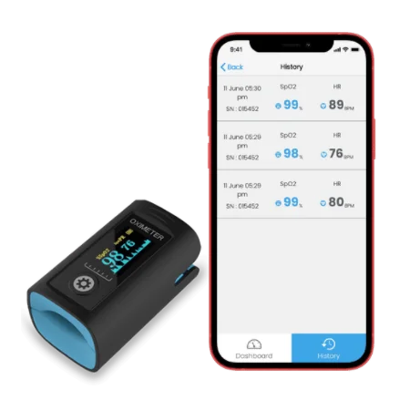 https://healthmote.com/wp-content/uploads/2021/11/Remote-Pulse-Oximeter.webp